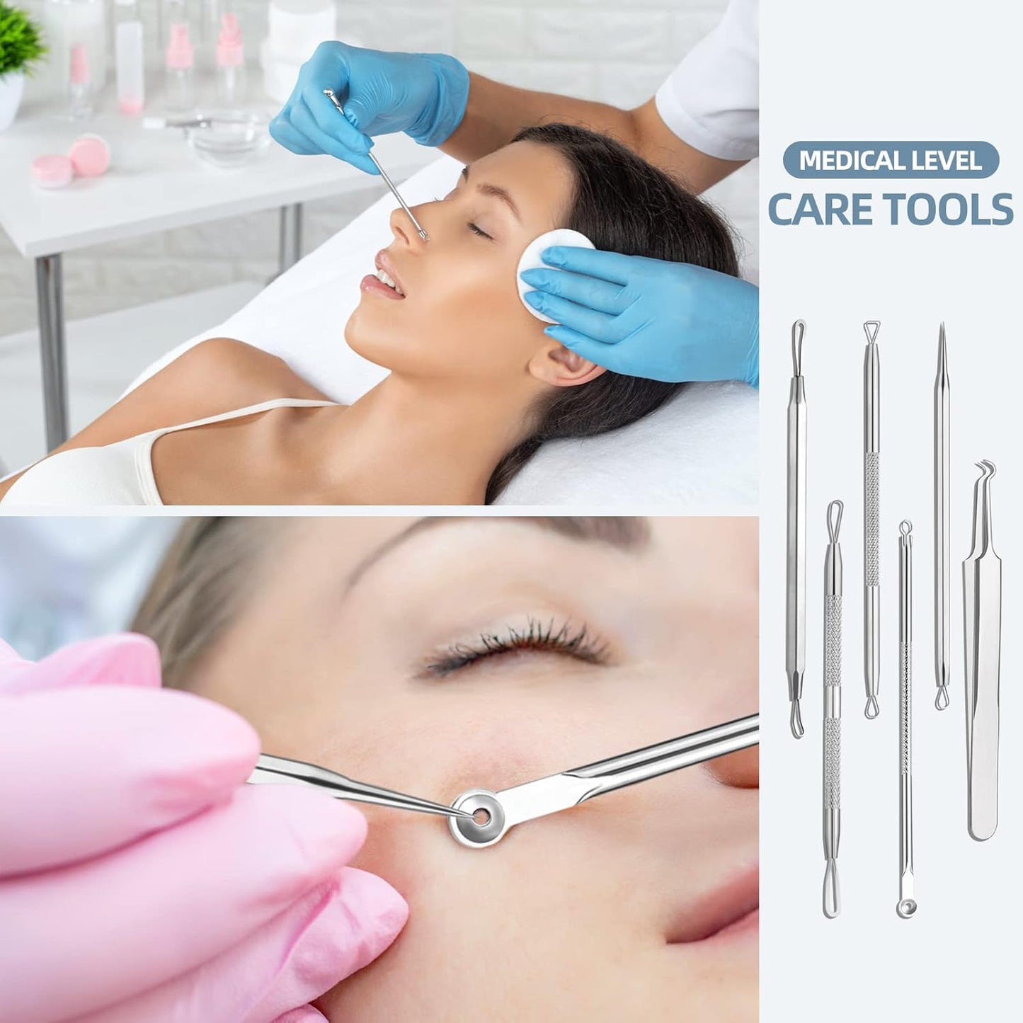 Blackhead Remover Tool Comedones Extractor Acne Removal Kit for Blemish, Whitehead Popping