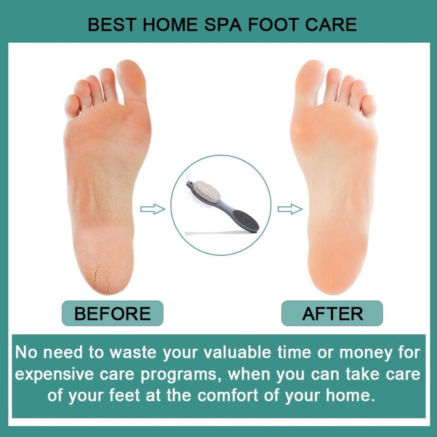 Foot File Callus Remover - Multi Purpose 4 in 1 Feet Pedicure Tools with Foot Scrubber